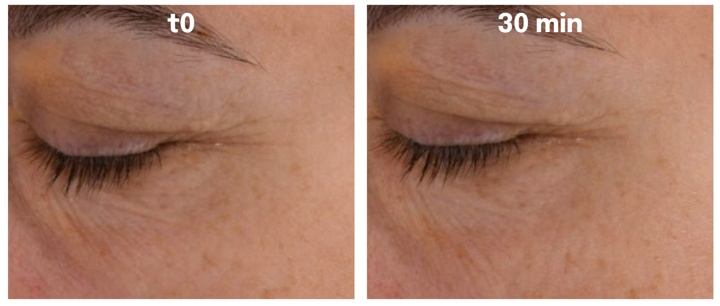 720x304 skin benefits solagum ax seppic