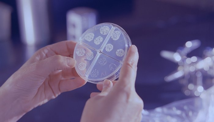 L'Oréal renforce sa recherche sur le microbiome avec l'acquisition de Lactobio